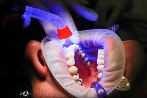 пасти за зъби без флуор - 39361 новини