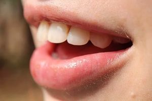 пасти за зъби без флуор - 22393 предложения